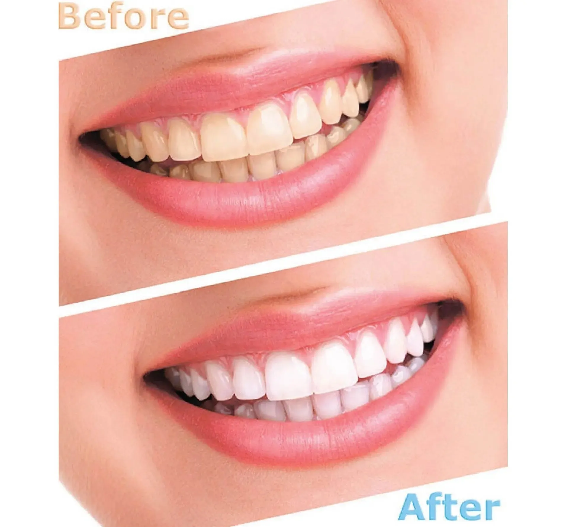 LUMA Smile Professional Tooth Whitening Instrument and Electric Tooth Cleaning Machine